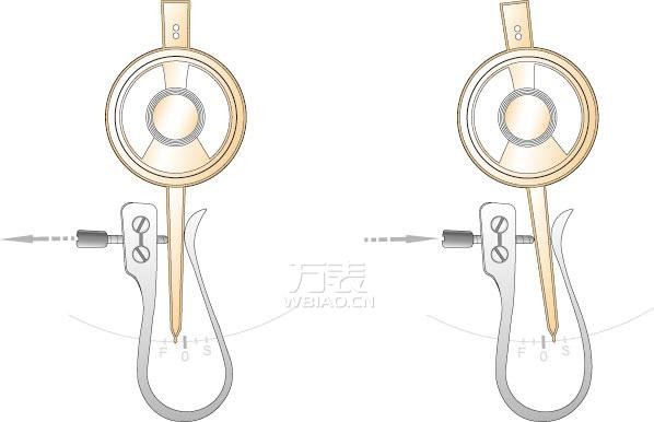 雷达手表不准是何原因？手表不准之游丝、快慢针常见故障
